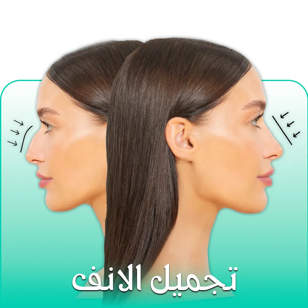 جراحة تجميل الأنف