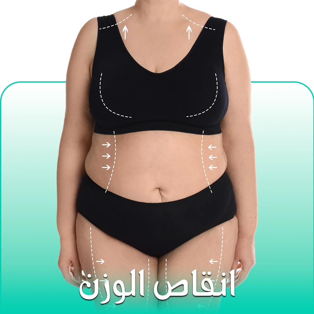 جراحة إنقاص الوزن